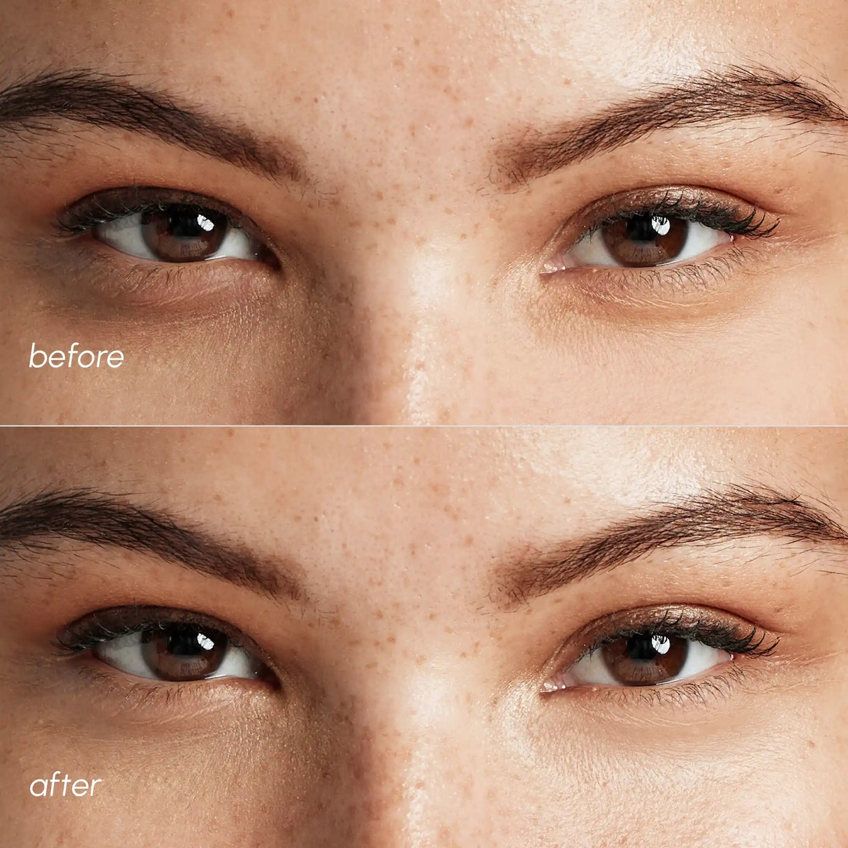 Parches Rosados para Ojos Hinchados