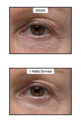 Murad Age Reform Rapid Collagen Infusion Collagen Serum - Anti-aging Hydrating Serum for All Skin Types