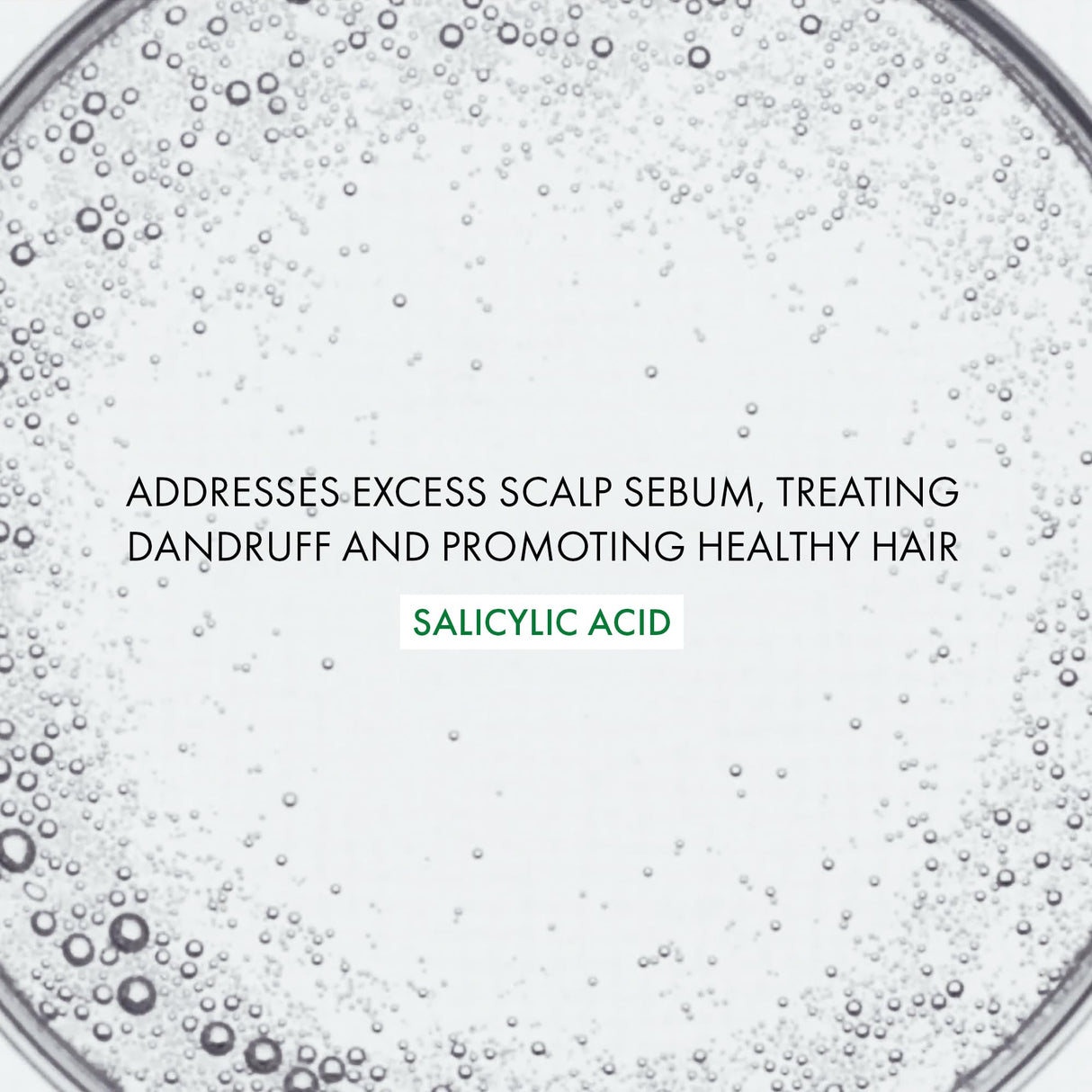 Vichy Dercos Anti-Dandruff Shampoo for Sensitive Scalps - Gentle, Effective Treatment - 200ml