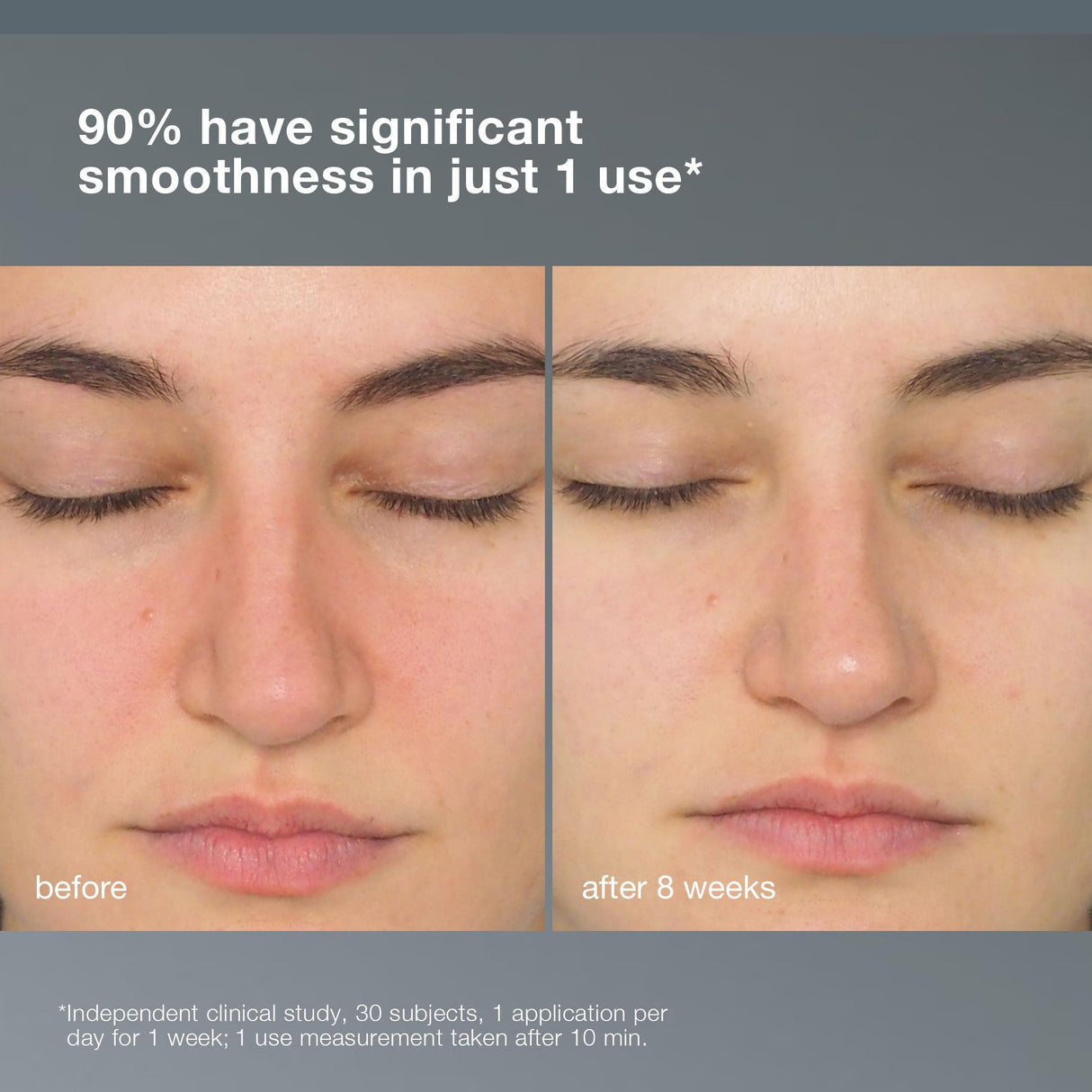 Dermalogica Daily Milkfoliant Exfoliating Powder - Gentle Natural Skincare for Sensitive Skin, Soothes & Nourishes with Oat Kernel Protein & Coconut Extract