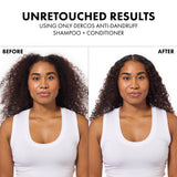 Vichy Dercos Anti-Dandruff Shampoo for Dry Hair - 500ml Refill, Dermatologically Tested, Paraben-Free