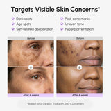 Sérum facial y corporal para manchas oscuras