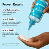 Tónico facial de ácido glicólico Glow Boost